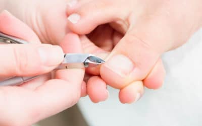 Stop Ingrown Toenails Before They Start