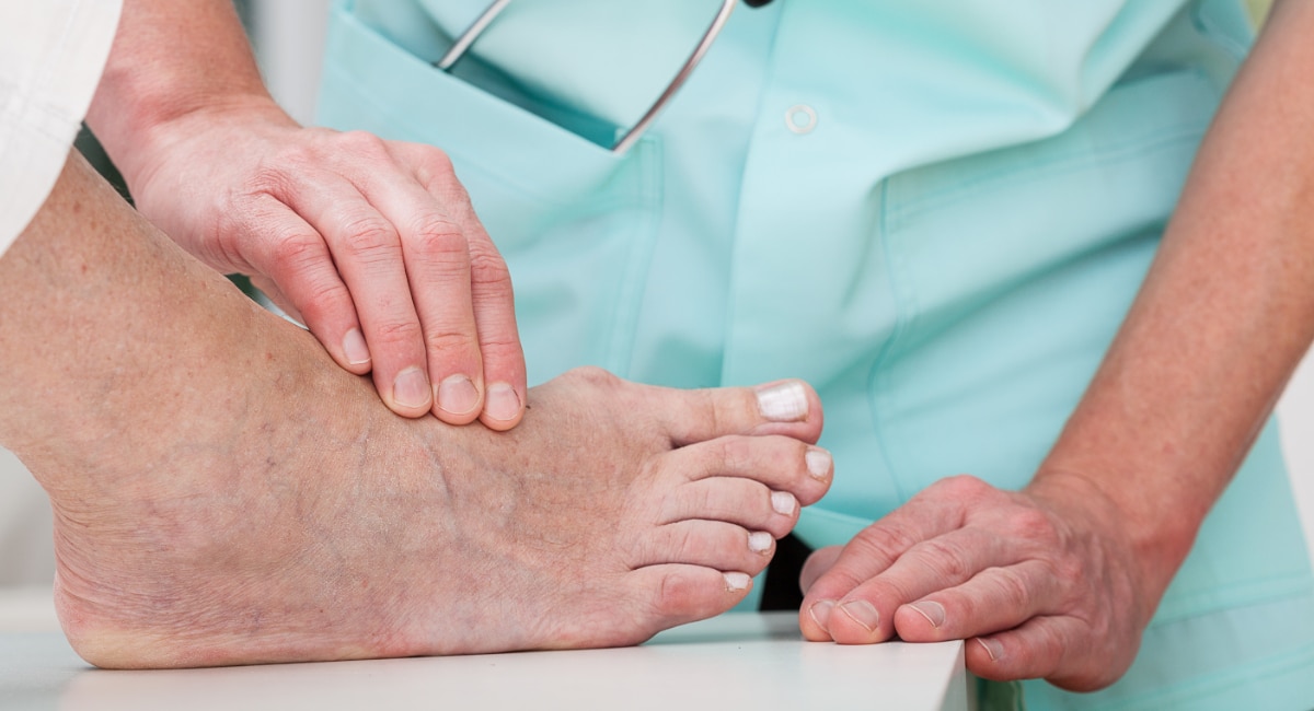 Doctor examining foot with bunion