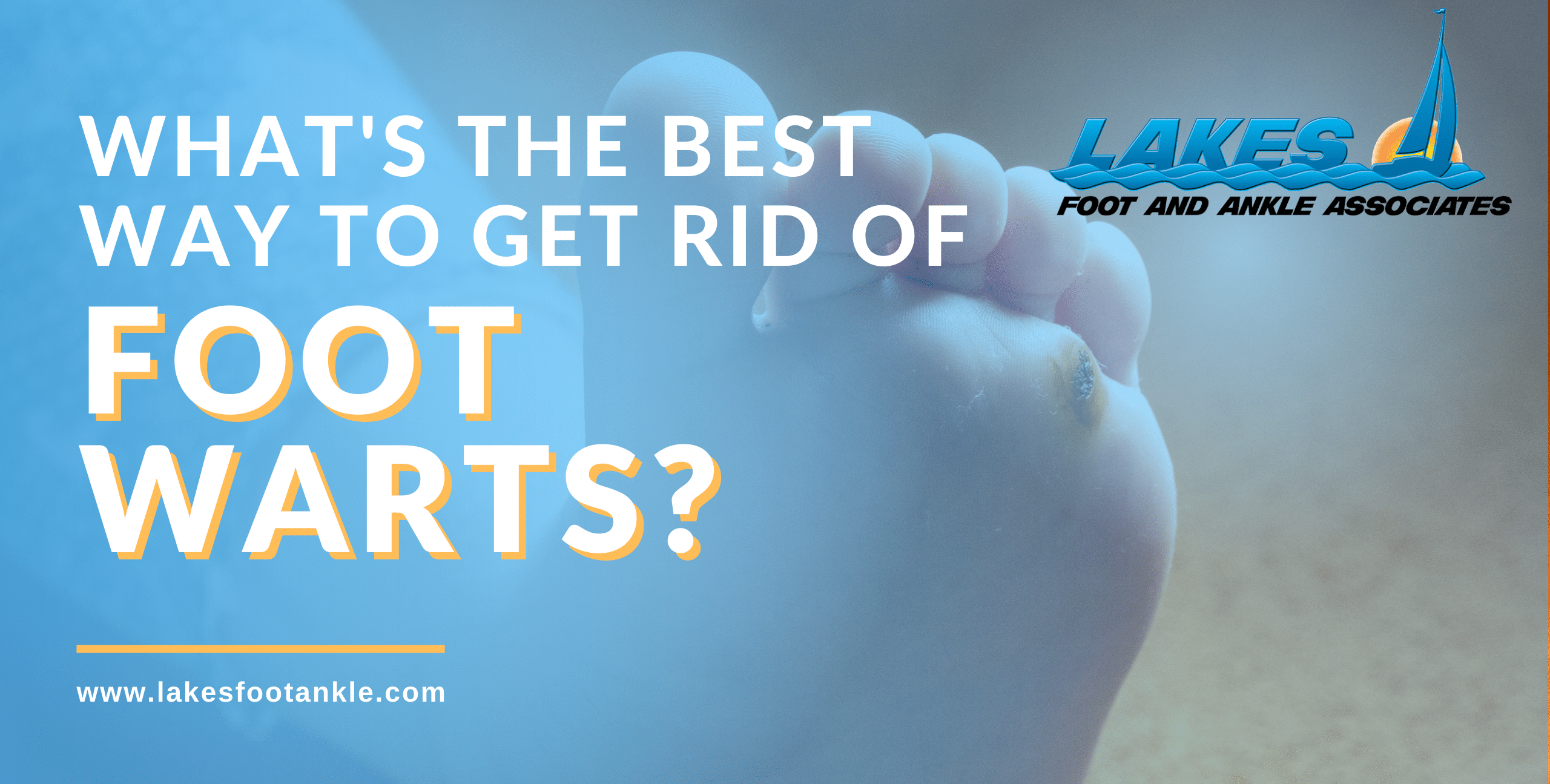 What’s the Best Way to Get Rid of Warts?